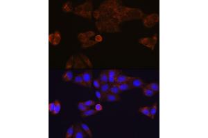 Immunofluorescence analysis of HeLa cells using CES1 Rabbit mAb (ABIN7266077) at dilution of 1:100 (40x lens). (CES1 抗体)