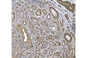 IHC analysis of DLAT using anti-DLAT antibody (ABIN7602307).