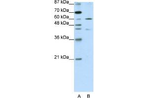 WB Suggested Anti-ZNF496 Antibody Titration:  1. (ZNF496 抗体  (N-Term))