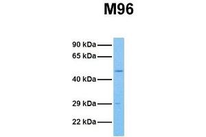 Host:  Rabbit  Target Name:  M96  Sample Tissue:  Human HCT116  Antibody Dilution:  1. (MTF2 抗体  (Middle Region))