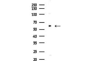 Western blot analysis of lysates from COLO205 cells(UV,30 min treatment), using TCP1 alpha Antibody at 1/1000 dilution.