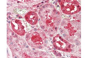 Immunohistochemistry (IHC) image for anti-Solute Carrier Family 14 (Urea Transporter), Member 1 (Kidd Blood Group) (SLC14A1) (AA 119-168) antibody (ABIN6752973)