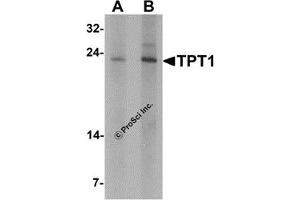 Western Blotting (WB) image for anti-Tumor Protein, Translationally-Controlled 1 (TPT1) antibody (ABIN1077430) (TPT1 抗体)