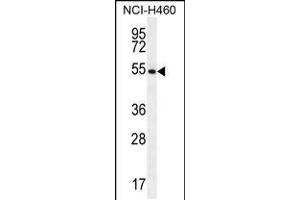 Western blot analysis in NCI-H460 cell line lysates (35ug/lane). (GS (AA 380-408), (C-Term) 抗体)
