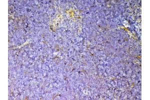 IHC analysis of CD59 using anti-CD59 antibody . (CD59a 抗体  (AA 24-96))