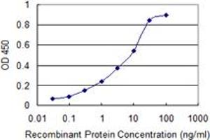 Detection limit for recombinant GST tagged SRD5A2 is 0. (SRD5A2 抗体  (AA 28-65))