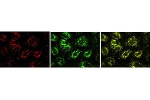 Immunofluorescence (IF) image for anti-Vesicle-Associated Membrane Protein 7 (VAMP7) antibody (ABIN1109463) (VAMP7 抗体)