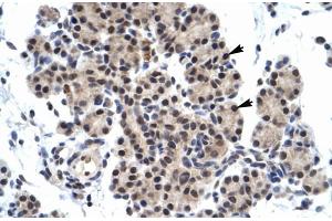 Human Pancreas (ZNF318 抗体  (N-Term))