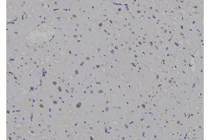 ABIN6269296 at 1/100 staining Human heart tissue by IHC-P. (14-3-3 zeta 抗体  (C-Term))