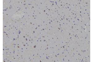 ABIN6269296 at 1/100 staining Human heart tissue by IHC-P. (14-3-3 zeta 抗体  (C-Term))