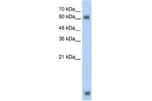 WB Suggested Anti-MBD1 Antibody Titration:  0.