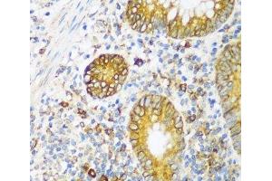 Immunohistochemistry of paraffin-embedded Human appendix using ERLIN1 Polyclonal Antibody at dilution of 1:100 (40x lens). (ERLIN1 抗体)