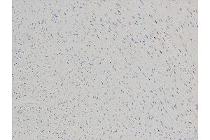 Immunohistochemistry (IHC) image for anti-Cofilin 1 (CFL1) (pSer3) antibody (ABIN6255180)
