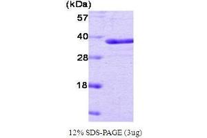 SDS-PAGE (SDS) image for Protein tyrosine Phosphatase, Non-Receptor Type 1 (PTPN1) (Active) protein (ABIN934895)