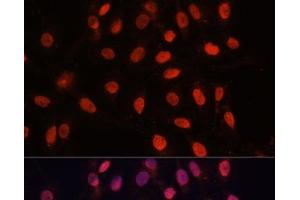 Immunofluorescence analysis of U-2 OS cells using Bcl-2 Polyclonal Antibody at dilution of 1:100 (40x lens). (Bcl-2 抗体)