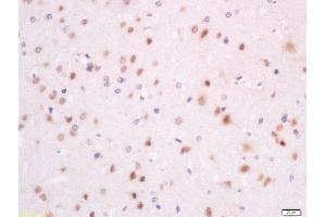 Formalin-fixed and paraffin embedded rat brain labeled with Anti-SFRS7/9G8 Polyclonal Antibody, Unconjugated  at 1:200 followed by conjugation to the secondary antibody and DAB staining (SFRS7 抗体  (AA 2-70))