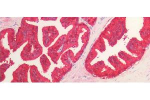 Detection of IDH1 in Human Prostate Tissue using Monoclonal Antibody to Isocitrate Dehydrogenase 1, Soluble (IDH1) (IDH1 抗体  (AA 74-333))