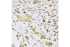 Immunohistochemistry (Paraffin-embedded Sections) (IHC (p)) image for anti-Glycerol Phosphate Dehydrogenase 2, Mitochondrial (GPD2) (AA 25-325) antibody (ABIN6141318)