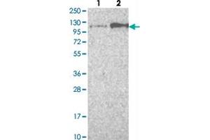 Western blot analysis of Lane 1: Negative control (vector only transfected HEK293T lysate) Lane 2: Over-expression lysate (Co-expressed with a C-terminal myc-DDK tag (~3. (FGFR4 抗体)