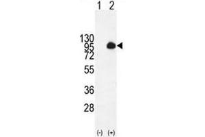 Western blot analysis of MUC20 antibody and 293 cell lysate (2 ug/lane) either nontransfected (Lane 1) or transiently transfected with the MUC20 gene (2). (MUC20 抗体  (AA 61-90))