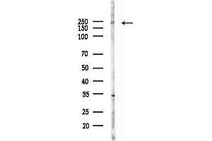 anti-Dedicator of Cytokinesis 4 (DOCK4) antibody