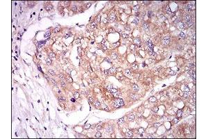 Immunohistochemistry (IHC) image for anti-tyrosine Kinase with Immunoglobulin-Like and EGF-Like Domains 1 (TIE1) (AA 385-607) antibody (ABIN2683016)