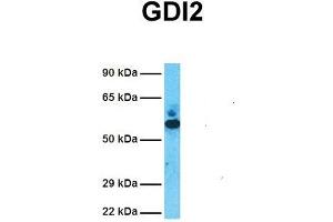 Host:  Rabbit  Target Name:  GDI2  Sample Tissue:  Human Fetal Lung  Antibody Dilution:  1. (GDI2 抗体  (C-Term))