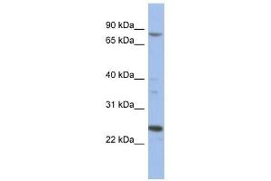 MARK3 antibody used at 1 ug/ml to detect target protein. (MARK3 抗体  (Middle Region))
