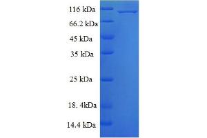 SDS-PAGE (SDS) image for Mitogen-Activated Protein Kinase 6 (MAPK6) (AA 1-721), (full length) protein (His-SUMO Tag) (ABIN5709907)