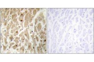 Immunohistochemistry analysis of paraffin-embedded human heart tissue, using FOXD3 Antibody. (FOXD3 抗体  (AA 211-260))