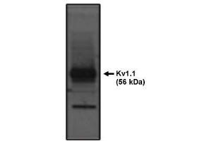 Image no. 1 for anti-Potassium Voltage-Gated Channel, Shaker-Related Subfamily, Member 1 (KCNA1) antibody (ABIN265021) (KCNA1 抗体)