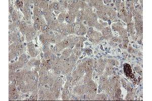 Image no. 5 for anti-Diphthamide Biosynthesis Protein 2 (DPH2) antibody (ABIN1497892)