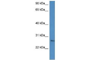 WB Suggested Anti-CMA1 Antibody Titration: 0. (CMA1 抗体  (C-Term))