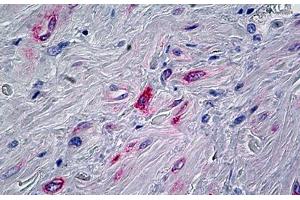 Immunohistochemistry (Formalin-fixed Paraffin-embedded Sections) (IHC (fp)) image for anti-Protein Phosphatase 1, Regulatory Subunit 13 Like (PPP1R13L) (AA 75-125) antibody (ABIN625891)