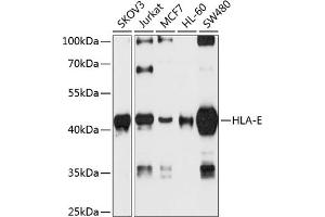 Western Blotting (WB) image for anti-HLA Class I Histocompatibility Antigen, alpha Chain E (HLA-E) (AA 1-100) antibody (ABIN6141843)