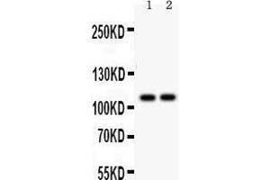 Anti- ATP2A1 antibody, Western blotting All lanes: Anti ATP2A1  at 0. (ATP2A1/SERCA1 抗体  (N-Term))