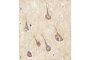 (ABIN6242948 and ABIN6577962) staining NPY2R in Human brain tissue sections by Immunohistochemistry (IHC-P - paraformaldehyde-fixed, paraffin-embedded sections). (NPY2R 抗体  (N-Term))