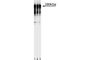 Western Blotting (WB) image for anti-Microtubule-Associated Protein 2 (MAP2) antibody (ABIN967494) (MAP2 抗体)
