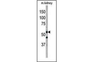 Western blot analysis of ATG4D Antibody  in mouse kidney tissue lysate.
