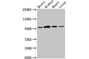 Western Blot Positive WB detected in: Rat brain tissue, Rat kidney tissue, Mouse heart tissue, Mouse liver tissue All lanes: NAA15 antibody at 3 μg/mL Secondary Goat polyclonal to rabbit IgG at 1/50000 dilution Predicted band size: 102, 62 kDa Observed band size: 95 kDa (NAA15 抗体  (AA 742-865))