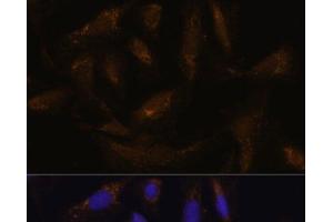 Immunofluorescence analysis of U-2 OS cells using SLC25A27 Polyclonal Antibody at dilution of 1:100. (SLC25A27 抗体)