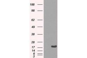 Image no. 2 for anti-Crystallin, alpha B (CRYAB) antibody (ABIN1497641) (CRYAB 抗体)