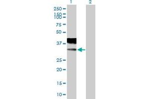 Western Blotting (WB) image for anti-Calcium Channel, Voltage-Dependent, gamma Subunit 2 (CACNG2) (AA 1-323) antibody (ABIN523764)