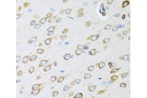 Immunohistochemistry of paraffin-embedded Rat brain using OGN Polyclonal Antibody at dilution of 1:100 (40x lens). (OGN 抗体)