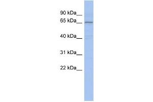 WB Suggested Anti-PIAS1 Antibody Titration:  0. (PIAS1 抗体  (Middle Region))