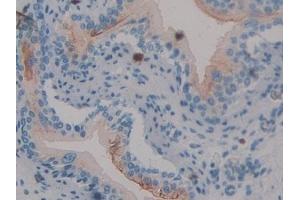 Immunohistochemistry (IHC) image for anti-Clusterin (CLU) (AA 227-448) antibody (ABIN7433225)