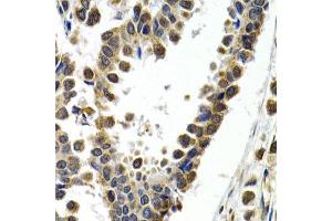 Immunohistochemistry (Paraffin-embedded Sections) (IHC (p)) image for anti-Activating Transcription Factor 2 (ATF2) (AA 1-190) antibody (ABIN3023064)