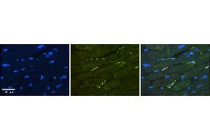 Rabbit Anti-GREB1 Antibody    Formalin Fixed Paraffin Embedded Tissue: Human Adult heart  Observed Staining: Membrane Primary Antibody Concentration: 1:600 Secondary Antibody: Donkey anti-Rabbit-Cy2/3 Secondary Antibody Concentration: 1:200 Magnification: 20X Exposure Time: 0. (GREB1 抗体  (Middle Region))