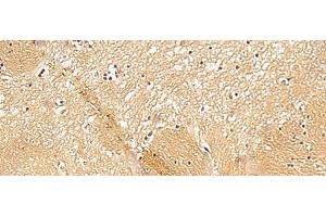 Immunohistochemistry of paraffin-embedded Human brain tissue using TXNDC12 Polyclonal Antibody at dilution of 1:50(x200) (TXNDC12 抗体)