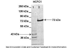 Lanes:   Lane1: HIS-HCFC1 16-363aa (42kD) transformed bacteria lysate Lane2: GFP-HCFC1 363-2002aa (73kD) transformed bacteria lysate elution sample  Primary Antibody Dilution:   1:1000  Secondary Antibody:   Anti-rabbit AlexaFluor 680  Secondary Antibody Dilution:   1:10000  Gene Name:   HCFC1  Submitted by:   Anonymous (HCFC1 抗体  (Middle Region))